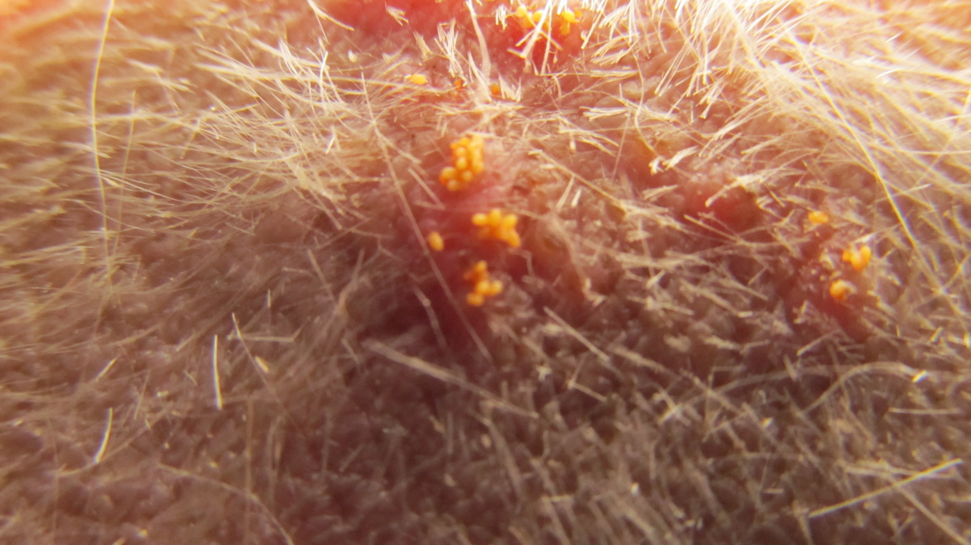 How To Get Rid of Ear Mites in Cats Home Remedies for Ear Mites in